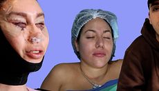 Cambios estéticos radicales