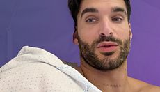 Edi se somete a una ginecomastia