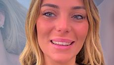 Claudia se somete a varios retoques estéticos