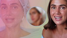Maica se inyecta esperma de salmón en el rostro