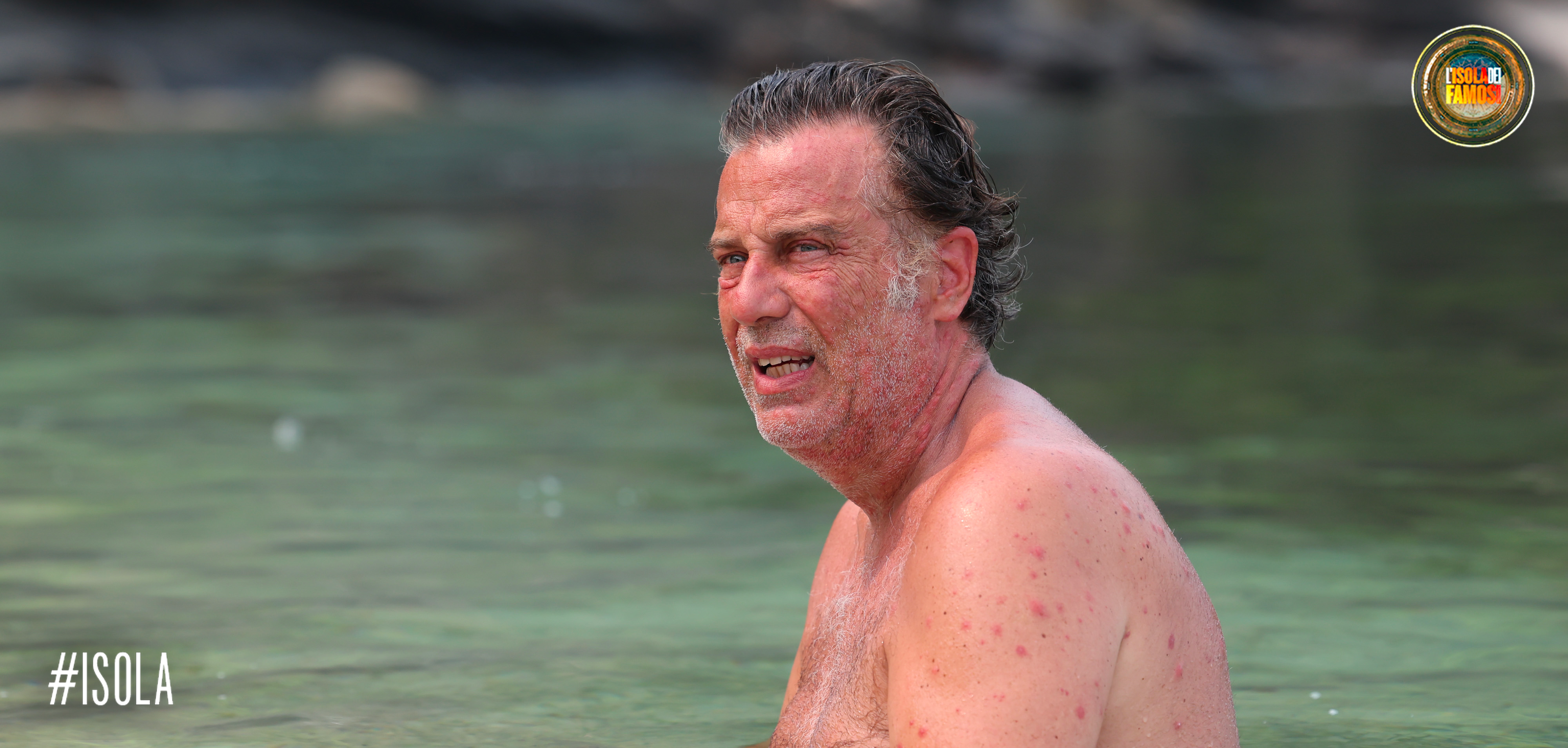 I mosquitos hanno decisamente preso di mira Dario!
