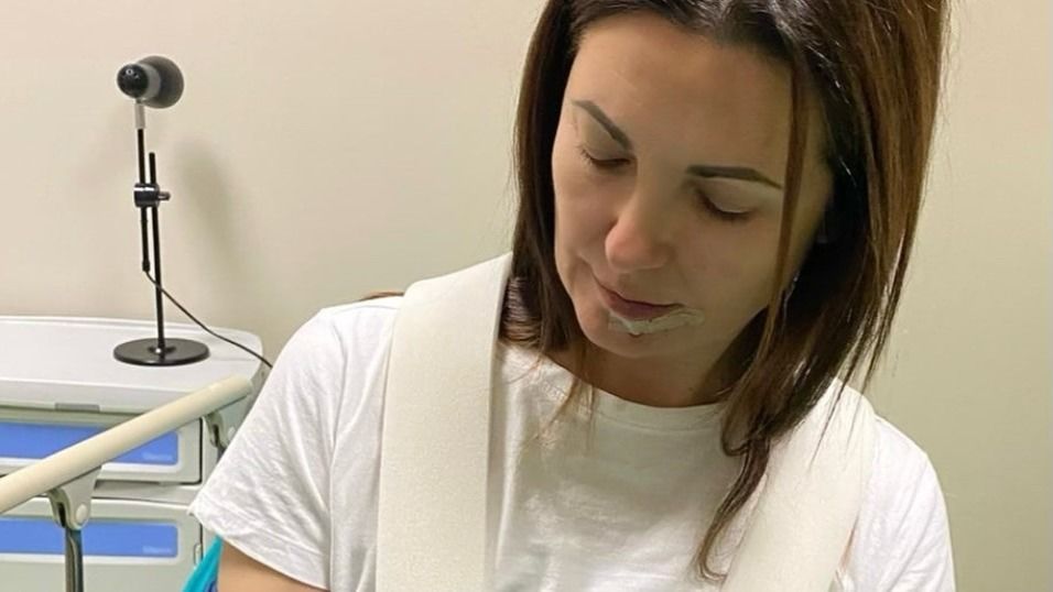 Giovanna Civitillo dopo l'incidente