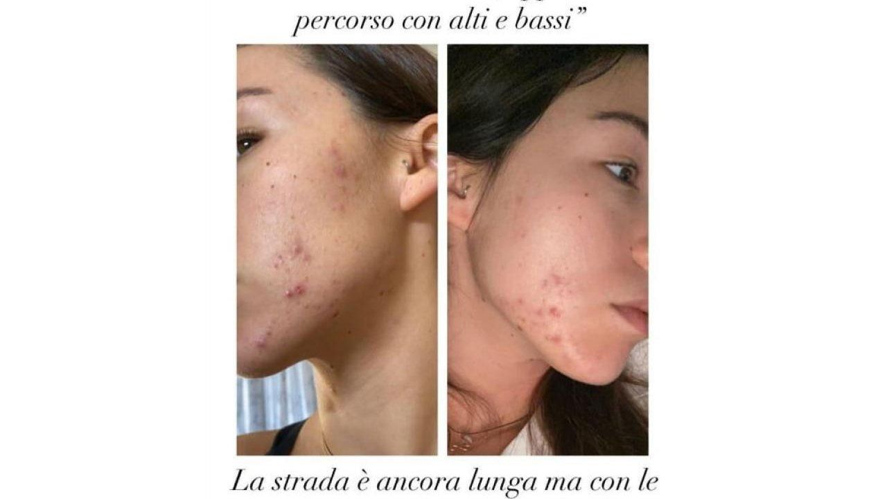 Foto Instagram @therealauroragram