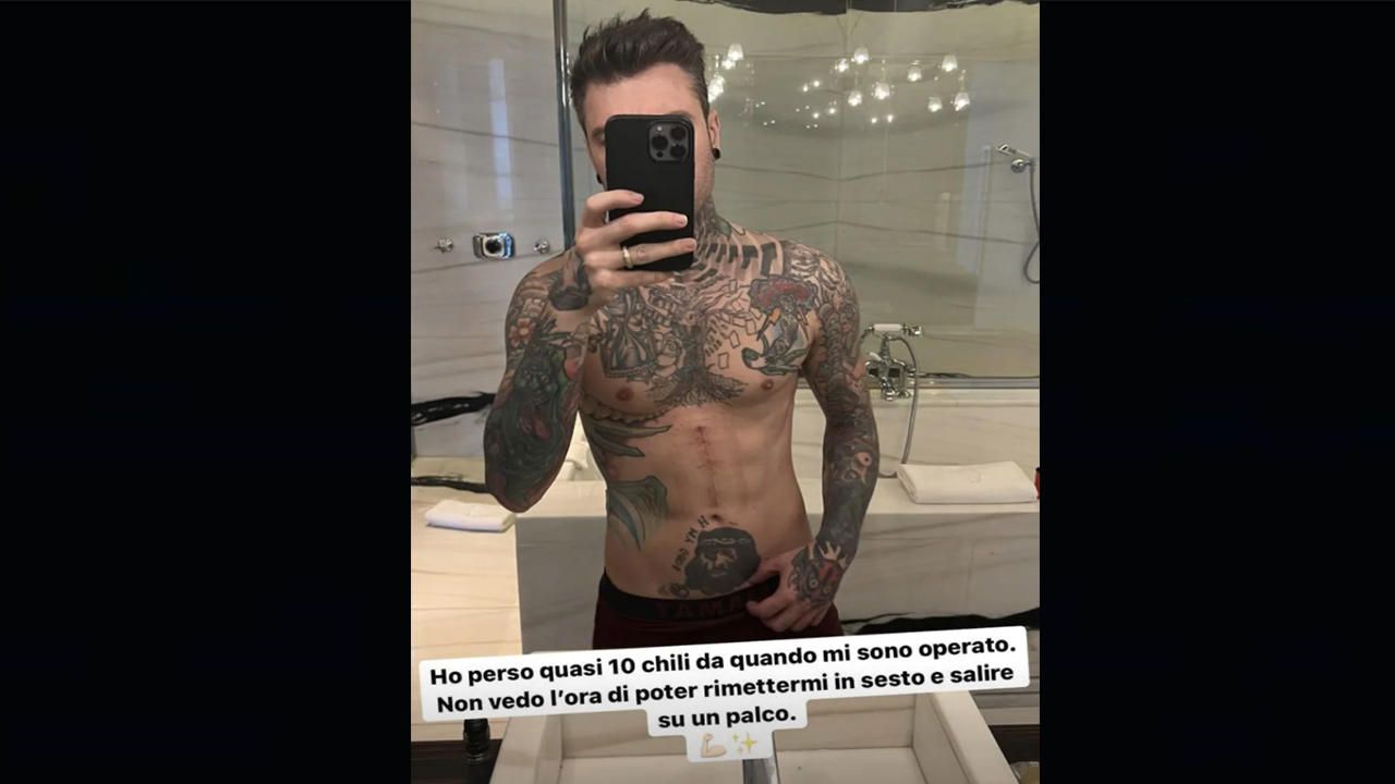 Foto Instagram @fedez