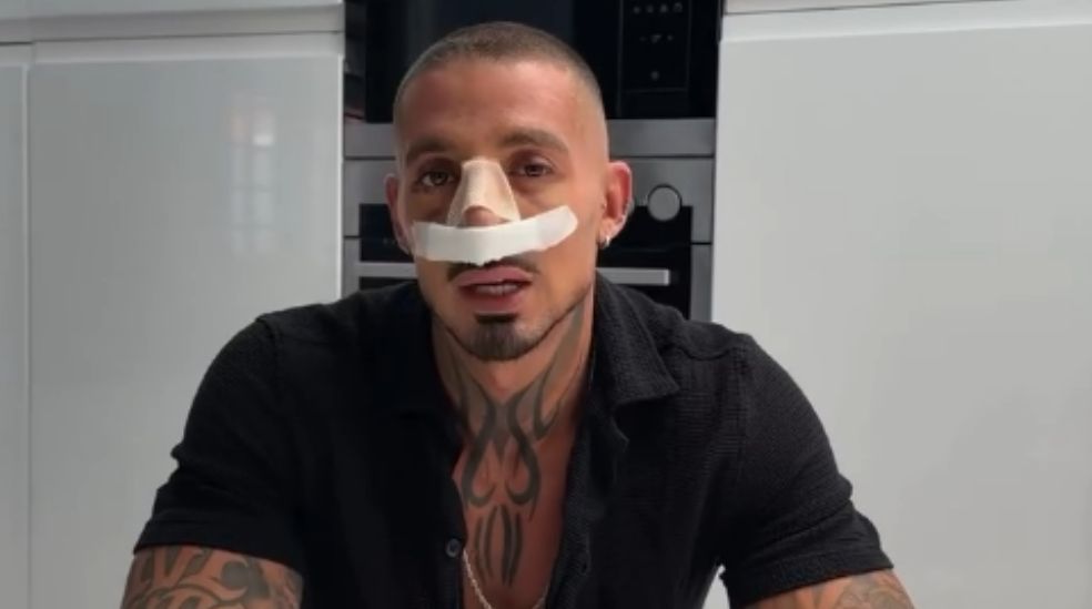 José muestra su evolución y cómo está viviendo el proceso de su rinoseptoplastia