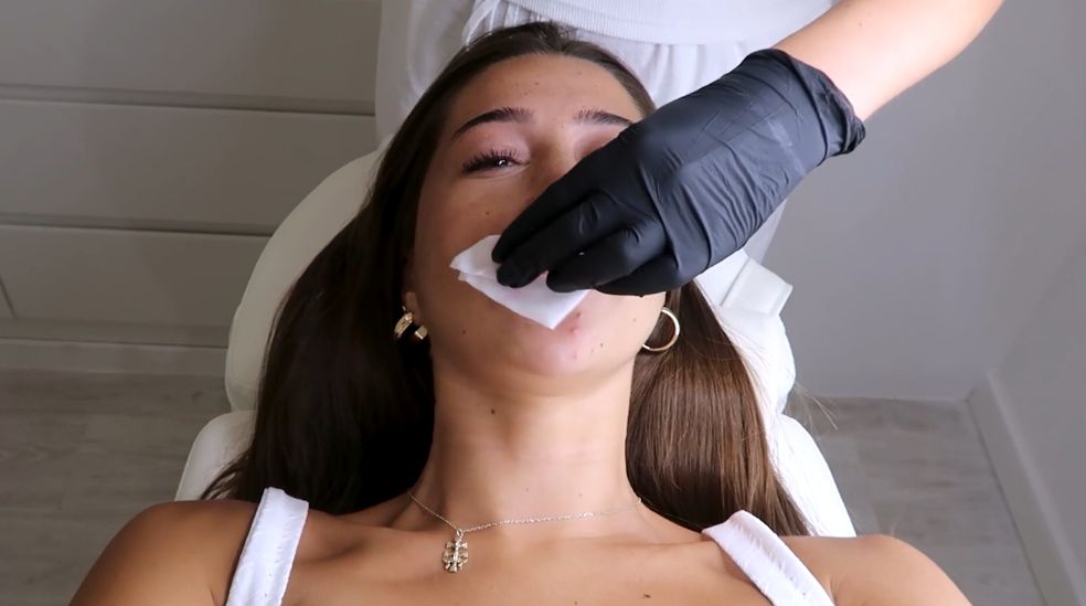 Mar Ruiz se quita el ácido de los labios y enseña el resultado
