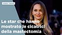 Le star che hanno mostrato le cicatrici della mastectomia