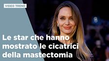 Le star che hanno mostrato le cicatrici della mastectomia