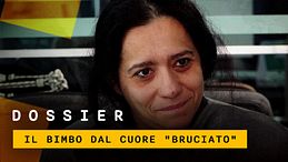 Bimbo trapiantato a Napoli, la storia di Domenico e del "cuore bruciato"