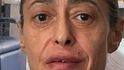 Gerardina Trovato: "Dovrò essere operata d'urgenza"