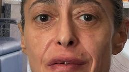 Gerardina Trovato: "Dovrò essere operata d'urgenza"