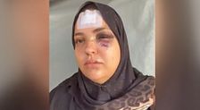 El brutal ataque a ladrillazos a una mujer en Ceuta con su bebé en brazos: "Una salvajada"