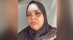 El brutal ataque a ladrillazos a una mujer en Ceuta con su bebé en brazos: "Una salvajada"