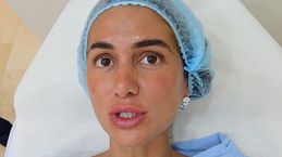 Maica Benedicto se inyecta esperma de salmón en la cara y en el cuello: su último retoque estético