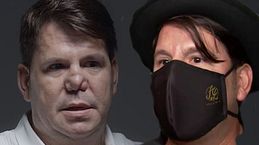 Qué causó el deterioro de la nariz de Lucas, de Andy y Lucas: complicaciones que sufrió con su rinoplastia
