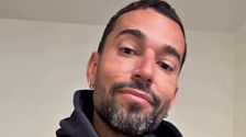 Omar Sánchez y sus cambios de imagen: todos sus retoques estéticos