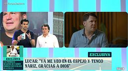 Lucas se somete a su segunda operación de nariz: “Va a emprender un nuevo proyecto”