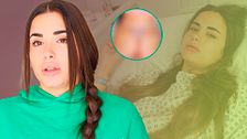 Cap.140 - Nieves se hace una lipotransferencia de glúteos: el resultado