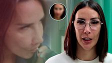 Cap.153 - Fani cambia su cara por completo con una cirugía: su rostro irreconocible