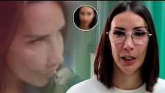 Cap.153 - Fani cambia su cara por completo con una cirugía: su rostro irreconocible