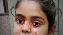 El curioso caso de la niña que llora sangre