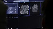 ‘Cuarto milenio’ logra lo imposible al analizar el cerebro de un testigo de aparición paranormal