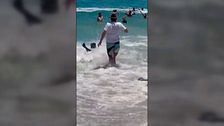 El feroz ataque de una foca a un niño tras ingerir un ácido: “Se vuelven agresivas”