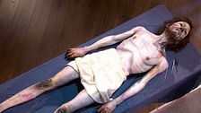 ¿Por qué se oscurecen las partes del cuerpo de los supervivientes de Los Andes? Las consecuencias del frío