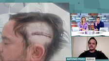 El sobrecogedor testimonio de un hombre agredido en plena calle por un menor: “Sin mediar palabra, me clavó un cuchillo en la cabeza”