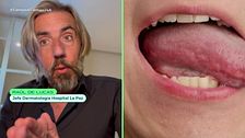 Así es tu salud según tu lengua: un dermatólogo da las claves