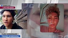 Una mujer trans, víctima de una brutal agresión: ''Pensaba que me moría, estaba paralizada''