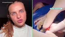 Hablamos con la influencer que lloró de dolor por un blanqueamiento dental en Tailandia: “Nunca he sufrido tal dolor en la boca”