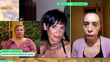 La picadura de una garrapata le ha arruinado la vida: “Los dolores no se me quitaban ni con morfina”