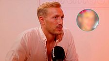 Rubén Torres muestra el antes y después de su rinoplastia