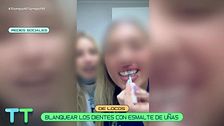 De locos: la nueva moda para blanquearse los dientes utilizando esmalte de uñas