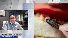 Un odontólogo alerta sobre la nueva moda viral de blanquearse los dientes con esmalte de uñas: "Te puedes intoxicar"