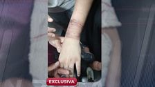 Una mujer es secuestrada y atada de pies y manos con bridas durante un mes por su marido: "Está muy asustada"