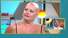 A Ana le cambió la vida cuando empezó a sufrir alopecia: "Tuve depresión, fueron años muy duros"