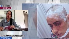 El infierno de Ana María y su hija, quemadas vivas por su expareja: "He tenido que vender el coche para pagarme las operaciones"