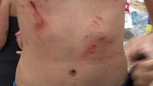 Cubierto de heridas y mojado: así ha quedado el cuerpo de un joven que ha estado de fiesta en la Barceloneta