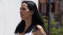 La nueva cara de Paola Olmedo tras someterse a una intervención quirúrgica de mandíbula
