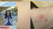 Preocupación ante una plaga de chinches en el aeropuerto de Madrid: "Es un problema de salud, de higiene y de seguridad"