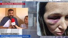 Salvaje paliza a una mujer embarazada y su marido por parte de los okupas de su casa: "Vinieron a matarnos"