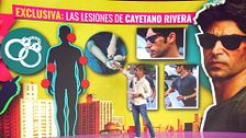 Exclusiva | Los detalles de las lesiones de Cayetano tras el altercado policial: así son los dos partes médicos