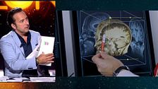 La investigación sobre qué ocurre en el cerebro de corrupto: "Se va convirtiendo en una adicción"
