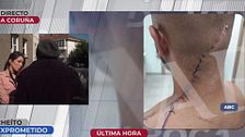 Una pedida de mano termina en una encerrona mortal en Santiago de Compostela: “Todo comenzó porque se le cayeron unas gotitas de la copa”
