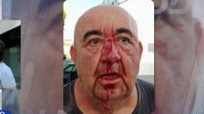Un militante de VOX apedrea a un concejal del PSOE de Aldosux (Almería): “Utilizaba la piedra como si fuera un martillo”