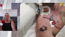 La denuncia de la tía del hombre con discapacidad asesinado por una paliza: “No se podía defender y ahora está en el cementerio”