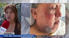 Nueva paliza en Parla a un anciano enfermo, su hija busca a los culpables: "Mi padre ha pasado semanas terribles"