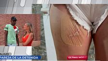 Aliud, expareja de la mujer que secuestró a otra y le quemó sus partes íntimas por celos: “Si consume heroína no es capaz de controlarse”